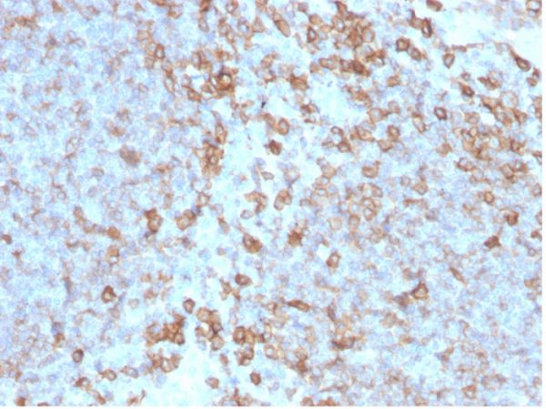 Formalin-fixed, paraffin-embedded human tonsil stained with CD27-Monospecific Mouse Monoclonal Antibody (LPFS2/4176).