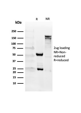 SDS-PAGE Analysis of Purified CD27 Mouse Monoclonal Antibody (LPFS2/4176). Confirmation of Integrity and Purity of Antibody.