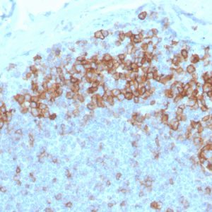 Formalin-fixed, paraffin-embedded human tonsil stained with CD27 Mouse Monoclonal Antibody (LPFS2/4177).