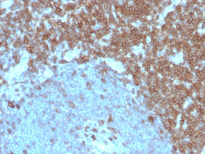 Formalin-fixed, paraffin-embedded human tonsil stained with CD27 Mouse Monoclonal Antibody (LPFS2/4179). CD27 (Tumor Necrosis Factor Receptor Superfamily 7) Antibody - Image 2