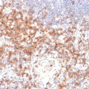 Formalin-fixed, paraffin-embedded human Lymph Node stained with CD27 Rabbit Recombinant Monoclonal Antibody (LPFS2/2034R).