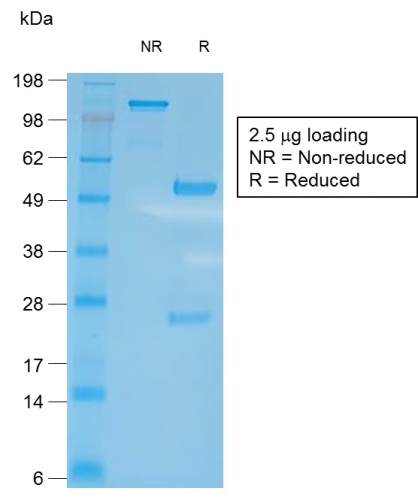 SDS-PAGE Analysis of Purified CD27 Rabbit Recombinant Monoclonal Antibody (LPFS2/2034R). Confirmation of Integrity and Purity of Antibody.