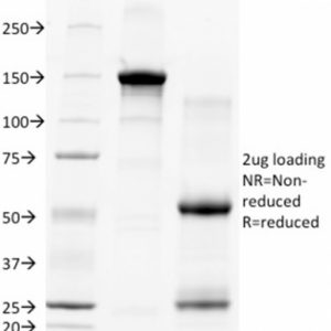 SDS-PAGE Analysis of Purified CD28 Mouse Monoclonal Antibody (C28/77). Confirmation of Integrity and Purity of Antibody.
