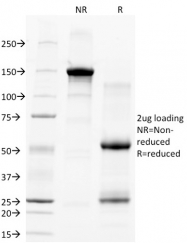 SDS-PAGE Analysis of Purified CD28 Mouse Monoclonal Antibody (C28/77). Confirmation of Integrity and Purity of Antibody.