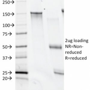 SDS-PAGE Analysis of Purified CD28 Mouse Monoclonal Antibody (C28/74). Confirmation of Integrity and Purity of Antibody.