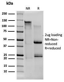 SDS-PAGE Analysis of Purified CD80 Mouse Monoclonal Antibody (C80/1608). Confirmation of Integrity and Purity of Antibody.