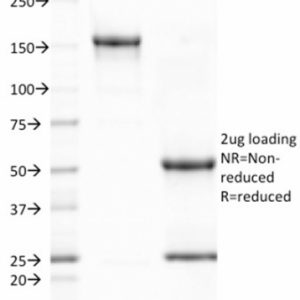 SDS-PAGE Analysis of Purified CD80 Mouse Monoclonal Antibody (C80/2723). Confirmation of Integrity and Purity of Antibody.