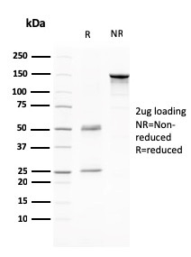 SDS-PAGE Analysis of Purified CD80 Mouse Monoclonal Antibody (C80/2776). Confirmation of Purity and Integrity of Antibody.