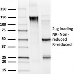 SDS-PAGE Analysis. Purified MED21 Mouse Monoclonal Antibody (PCRP-MED21-4B5).  Confirmation of Purity and Integrity of Antibody