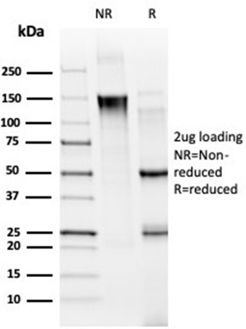 SDS-PAGE Analysis. Purified MED21 Mouse Monoclonal Antibody (PCRP-MED21-4B5). Confirmation of Purity and Integrity of Antibody MED21 / SRB7 Antibody