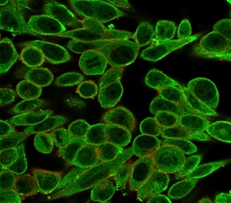 Immunofluorescence Analysis of PFA-fixed HeLa cells stained using MED21 Mouse Monoclonal Antibody (PCRP-MED21-4B5) followed by goat anti-mouse IgG-CF488. Membrane stained with phalloidin. MED21 / SRB7 Antibody - Image 4