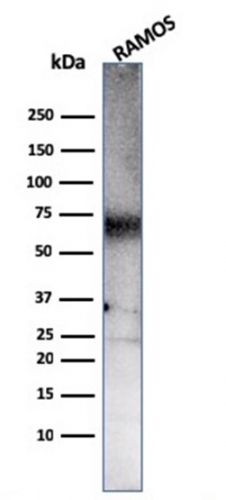 Western blot analysis of Ramos cell lsyate using CD86-Monospecific Mouse Monoclonal Antibody (C86/3711). CD86 (Dendritic Cells Maturation Marker) Antibody - Image 2