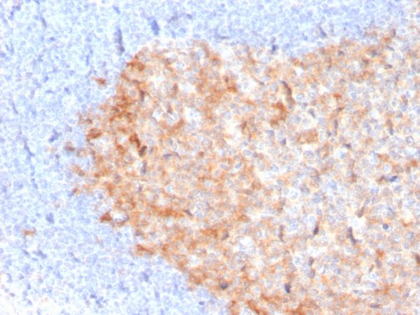 Formalin-fixed, paraffin-embedded human tonsil stained with CD86 Mouse Monoclonal Antibody (C86/3713).