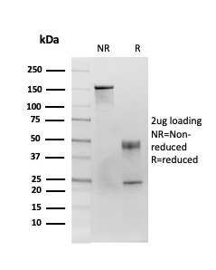 SDS-PAGE Analysis of Purified CD86 Mouse Monoclonal Antibody (C86/3713). Confirmation of Purity and Integrity of Antibody.