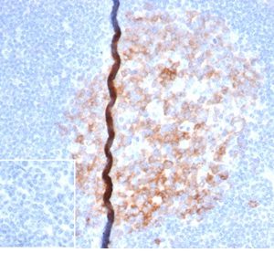IHC analysis of formalin-fixed, paraffin-embedded human lymph node. Staining of cell surface using rC86/6872 at 2ug/ml in PBS for 30min RT. Inset: PBS instead of primary antibody; secondary only negative control.