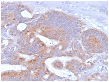 Formalin-fixed, paraffin-embedded human Colon stained with CD86 Mouse Recombinant Monoclonal Antibody (rC86/1146).
