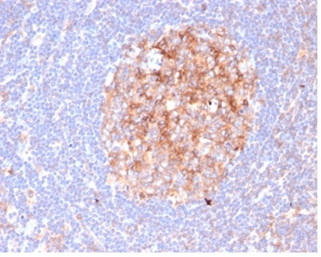 IHC analysis of formalin-fixed, paraffin-embedded human lymph node. Staining of cell surface using C86/6500R at 2ug/ml in PBS for 30min RT. HIER: Tris/EDTA, pH9.0, 45min. 2 °: HRP-polymer, 30min. DAB, 5min.