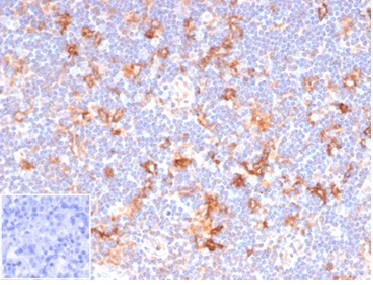 Formalin-fixed, paraffin-embedded human lymph node stained with CD86 Rabbit Recombinant Monoclonal Antibody (C86/6500R). Inset: PBS instead of primary antibody, secondary negative control.