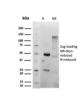 SDS-PAGE Analysis Purified CD86 Rabbit Recombinant Monoclonal Antibody (C86/6500R). Confirmation of Integrity and Purity of Antibody.