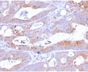 Formalin-fixed, paraffin-embedded human Colon stained with CD86 Rabbit Recombinant Monoclonal Antibody (C86/2160R).