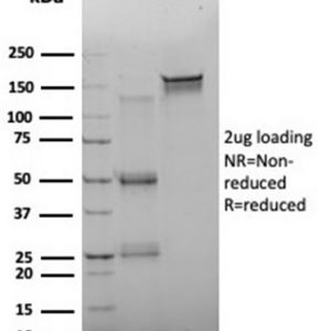SDS-PAGE Analysis. Purified FOXQ1 Mouse Monoclonal Antibody (PCRP-FOXQ1-2D2).  Confirmation of Purity and Integrity of Antibody.