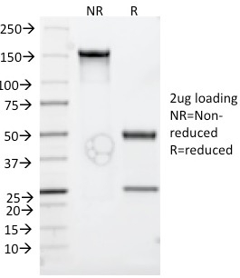 SDS-PAGE Analysis of Purified CD30 Monoclonal Antibody (Ki-1/779). Confirmation of Integrity and Purity of Antibody