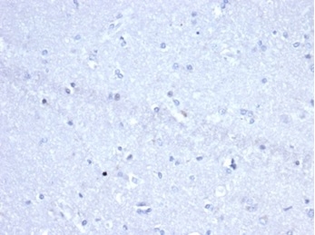 IHC analysis of formalin-fixed, paraffin-embedded human brain. Negative tissue control using Ki-1/4399R at 2ug/ml in PBS for 30min RT. HIER: Tris/EDTA, pH9.0, 45min. 2 °: HRP-polymer, 30min. DAB, 5min. Recombinant CD30 / TNFRSF8 (Hodgkin & Reed-Sternberg Cell Marker) Antibody - Image 2