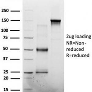 SDS-PAGE Analysis of Purified MED7 Mouse Monoclonal Antibody (PCRP-MED7-1B8). Confirmation of Purity and Integrity of Antibody.