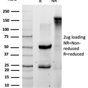 SDS-PAGE Analysis Purified QKI Mouse Monoclonal Antibody (PCRP-QKI-2F10) Confirmation of Purity and Integrity of Antibody.