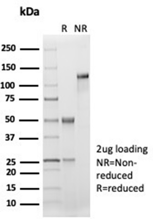 SDS-PAGE Analysis of Purified CD33 Recombinant Rabbit Monoclonal Antibody (SIGLEC3/7046R). Confirmation of Integrity and Purity of Antibody.