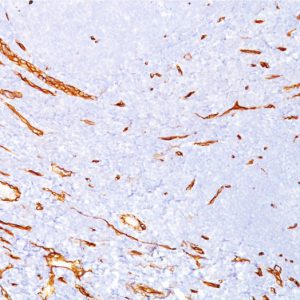 Formalin-fixed, paraffin-embedded human kidney stained with CD34 Mouse Monoclonal Antibody (CD34/4939). Inset: PBS instead of primary antibody; secondary only negative control.