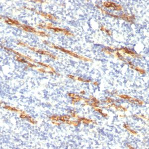 Formalin-fixed, paraffin-embedded human Tonsil stained with CD34 Monoclonal Antibody (QBEnd/10 + HPCA1/763)