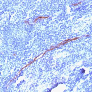 Formalin-fixed, paraffin-embedded human Tonsil stained with CD34 Rabbit Recombinant Monoclonal Antibody (HPCA1/1806R).