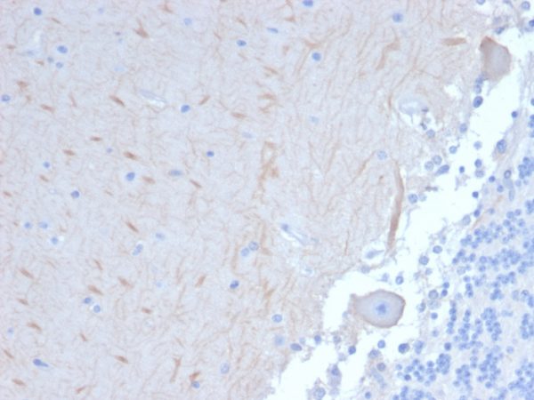 Formalin-fixed, paraffin-embedded human Brain stained with ATG5 Mouse Monoclonal Antibody (ATG5/2101).