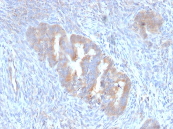 Formalin-fixed, paraffin-embedded human Endometrium stained with ATG5 Mouse Monoclonal Antibody (ATG5/2101).
