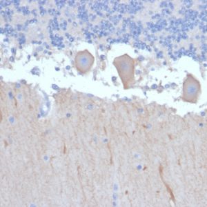 Formalin-fixed, paraffin-embedded human Brain stained with ATG5 Mouse Monoclonal Antibody (ATG5/2492).