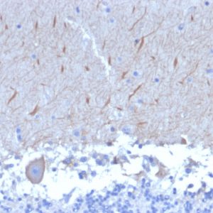 Formalin-fixed, paraffin-embedded human Brain stained with ATG5 Mouse Monoclonal Antibody (ATG5/2553).