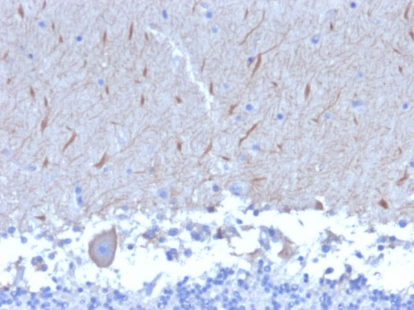 Formalin-fixed, paraffin-embedded human Brain stained with ATG5 Mouse Monoclonal Antibody (ATG5/2553).