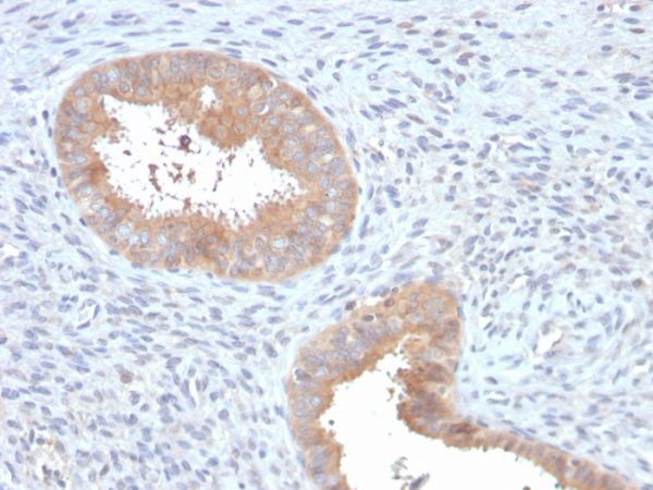 Formalin-fixed, paraffin-embedded human Uterus stained with ATG5 Mouse Monoclonal Antibody (ATG5/2553).