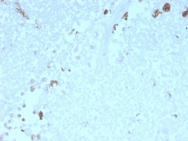 Formalin-fixed, paraffin-embedded human Uterus stained with ATG5 Mouse Monoclonal Antibody (rATG5/2553).