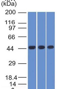 Western Blot of K562, HEK293 andA549 cell lysates Using Napsin A Mouse Monoclonal Antibody (NAPSA/1238).