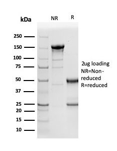 SDS-PAGE Analysis of Purified Naspin A Mouse Monoclonal Antibody (NAPSA/3305). Confirmation of Purity and Integrity of Antibody.