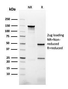 SDS-PAGE Analysis of Purified Naspin A Mouse Monoclonal Antibody (NAPSA/3307). Confirmation of Purity and Integrity of Antibody. Napsin A (Lung Adenocarcinoma Marker) Antibody - Image 3