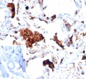 Formalin-fixed, paraffin-embedded human lung stained with Napsin A Recombinant Rabbit Monoclonal Antibody (NAPSA/7043R). Inset: PBS instead of primary antibody, secondary negative control.