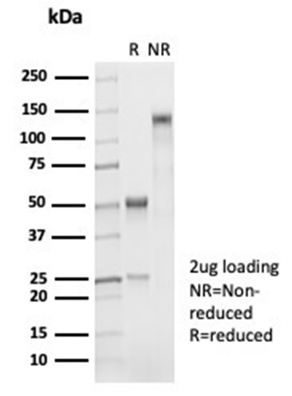 SDS-PAGE Analysis Purified Napsin A Mouse Monoclonal Antibody (NAPSA/7043R). Confirmation of Integrity and Purity of Antibody.
