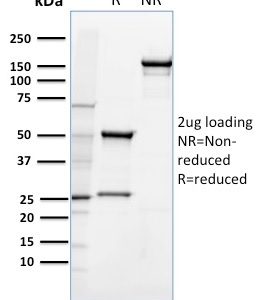 SDS-PAGE Analysis Purified CD36 Mouse Monoclonal Antibody (185-1G2). Confirmation of Integrity and Purity of Antibody.