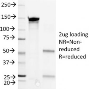 SDS-PAGE Analysis Purified CD36 Mouse Monoclonal Antibody (1E8). Confirmation of Purity and Integrity of Antibody.