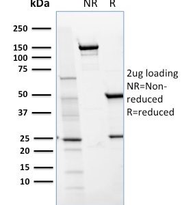 SDS-PAGE Analysis of Purified CD36 Mouse Monoclonal Antibody (GPIIIb/1654). Confirmation of Integrity and Purity of Antibody.