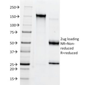 SDS-PAGE Analysis of Purified CD38 Mouse Monoclonal Antibody (AT1). Confirmation of Integrity and Purity of Antibody.