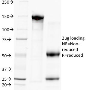SDS-PAGE Analysis of Purified CD38 Mouse Monoclonal Antibody (FS02). Confirmation of Purity and Integrity of Antibody.